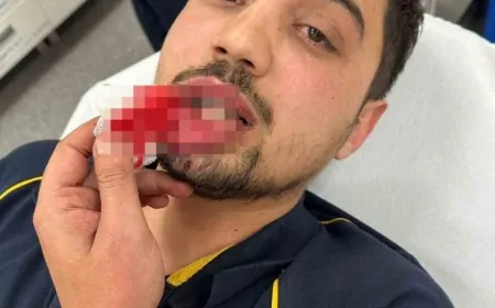 Bursa’da ambulans şoförü darp edildi