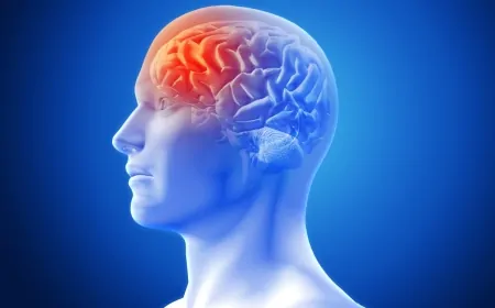 Beyin Kanaması Nedir? Belirtileri ve Nedenleri Nelerdir?